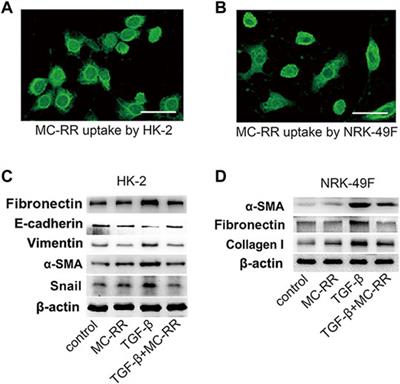 Renoprotection of Microcystin-RR in Unilateral Ureteral Obstruction-Induced Renal Fibrosis: Targeting the PKM2-HIF-1α Pathway